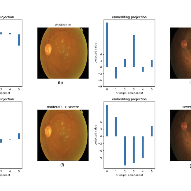 Inherent Vulnerabilities of Vision Transformers for Medical Image Classification