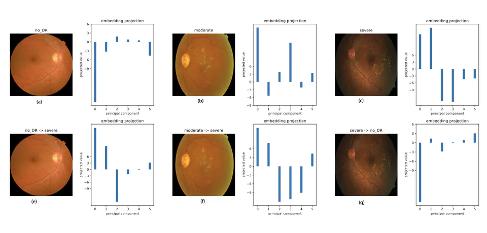 Inherent Vulnerabilities of Vision Transformers for Medical Image Classification